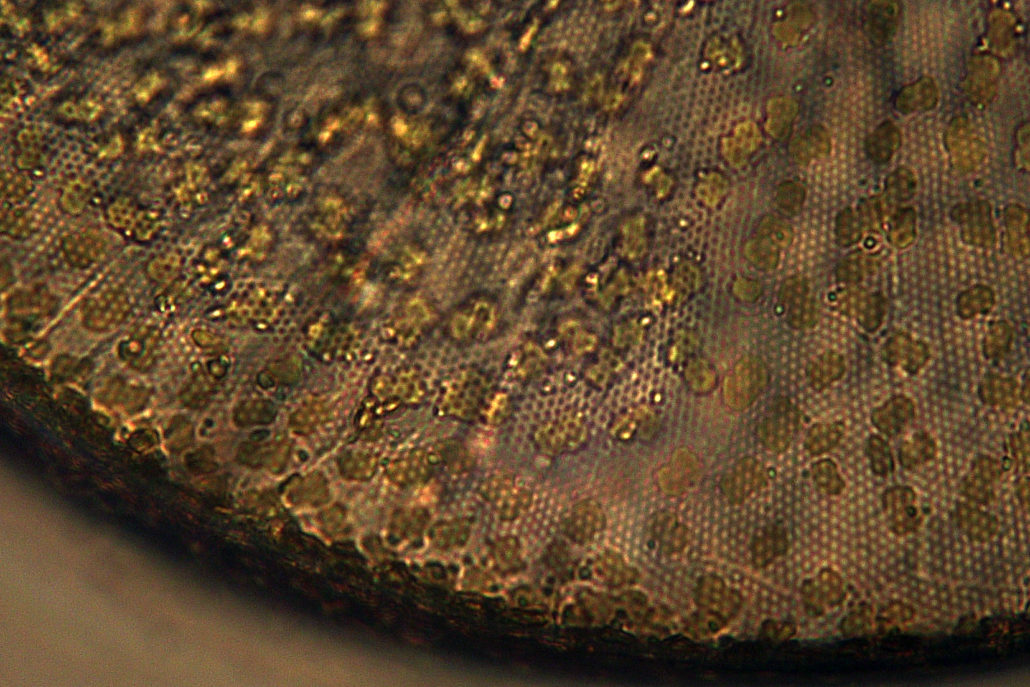 Diatom Close Up